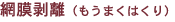 網膜剥離(もうまくはくり)